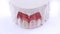 Wax pattern teeth dental crowns on model, metal free - front view .Ceramic front veneers isolated on black background.