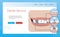 Web site layout with smile, dental implant, braces and caries for landing, flat stock vector illustration as a website template