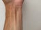 White male wrist and veins