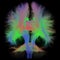 White Matter Tractography of the Human Brain in Coronal View