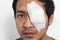 White medicine plaster patch on the eye