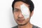 White medicine plaster patch on the eye