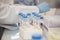 white rack with plastic test tubes in a science laboratory and an arm with labcoat and blue nitril gloves in the background.