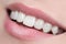 White, shiny and healthy smile