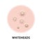 Whiteheads skin acne type vector icon. Skin disease acne whiteheads pimples type and face pore comedones