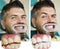 Whitening after and before. Man in dental chair. Dentist preparing for dental whitening. Health medicine people