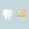 Whitening and teeth cleaning. Tooth before treatment and brushing yellow and sick, after white and healthy. Daily Oral Hygiene. De