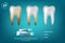 Whitening toothpaste ad poster. Vector realistic toothpaste packaging mock up with your brand on blue background with white