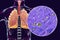Whooping cough bacteria Bordetella pertussis in human airways