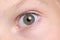 Wide open child`s eye with an eyebrow and moles on skin.