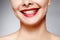 Wide smile of young beautiful woman, perfect healthy white teeth. Dental whitening, ortodont, care tooth and wellness