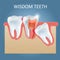 Wisdom teeth problems vector poster design template