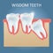 Wisdom teeth problems vector poster design template