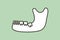 Wisdom tooth angular or mesial impaction in mandible or lower jaw