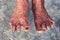 Withered feet of old woman, withered tan skin, healthy and long