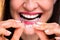 Woman Adjusting Transparent Aligners In Her Teeth