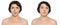 Woman with and without aging singes, double chin, worry wrinkles, nasolabial folds before and after cosmetic or plastic