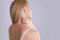 Woman with allergy symptoms scratching neck on grey background