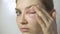 Woman with allergy touching eye