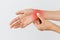 Woman arms holding her painful wrist caused by prolonged work on laptop, coloured in red.Carpal tunnel syndrome, arthritis