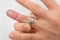 Woman cannot take off stuck wedding ring