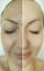 Woman caucasianwrinkles beautician mature lifting revitalization before and after treatment result