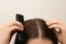 Woman with comb and dandruff in her dark hair on light background