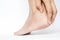 Woman cracked heels with white background, Foot healthy
