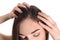 Woman with dandruff in her hair on background, closeup