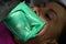 A woman at a dentist`s appointment, a dentist uses a rubber dam and dental tools for treatment