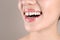Woman with diastema between upper front teeth on light grey background, closeup