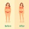 Woman before and after diet or weight loss.