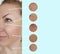 Woman eye adult wrinkles lifting skin difference mature beautician before and after collage procedures