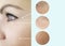 Woman eye adult wrinkles lifting skin  regeneration mature beautician before and after collage procedures