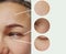 Woman eyes wrinkles bloatin skin effect results difference correction therapy concept contrast before and after