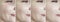 Woman face wrinkles before and after result antiaging difference therapy treatment collage