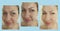 woman face wrinkles result difference skin regeneration cosmetology before and after collage rejuvenation treatment