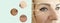 Woman face wrinkles skin before and after difference mature result correction removal regeneration problem treatment, lift, arrow