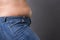 Woman with fat abdomen in blue jeans, overweight female stomach, stretch marks on belly closeup
