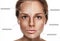 Woman freckle half-face happy young beautiful portrait with healthy skin half