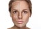 Woman freckle half-face happy young beautiful portrait healthy skin half