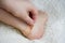 A woman glues a tissue plaster to a corn on her leg