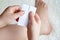 A woman glues a tissue plaster to a corn on her leg