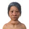 A woman with Graves' disease, 3D illustration