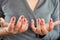 Woman hand suffering from joint pain with gout in finger