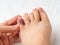 Woman hand touching little toe with purple bruise after home accident. Looking at bruised pinky toe of female person foot. Injury