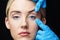 Woman has an examination of her skin before botox injection