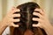 A woman has problems with hair and scalp,she has dandruff from allergic reactions to shampoos.