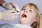 Woman having teeth examined by the Dental-Surgeon.