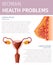 Woman Health Problem. Female Uterus and Breast